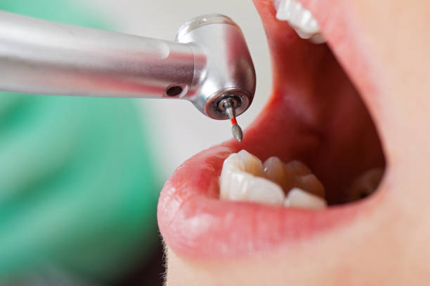 Best Broken or Cracked Tooth Emergency Dentist in Arma, KS